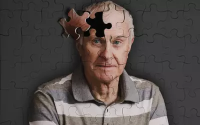 ‘Historic moment’: Drug slows cognitive decline in Alzheimer’s