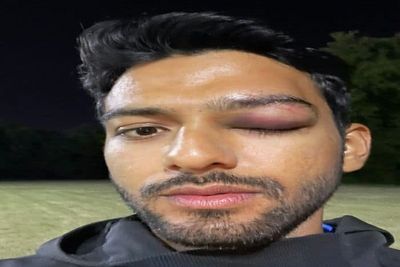Sports: Unmukt Chand suffers eye injury in US