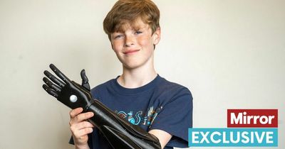 Youngsters with bionic arms have incredible day out from billionaire who paid for limbs
