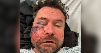 Dad who asked for directions beaten and left for dead in 'senseless' attack