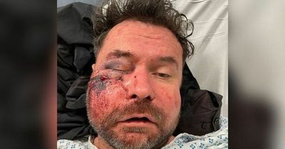 Dad who asked for directions beaten and left for dead in brutal attack