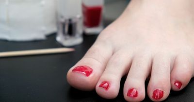 Itchy toe nails could be sign of a serious illness, experts say