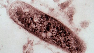 New tuberculosis vaccine possible in five years as researchers say vaccine effectiveness waning