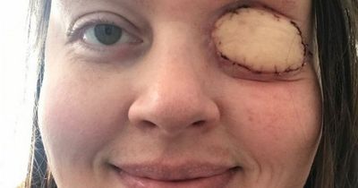 Mum has leg skin graft to cover eye socket which has its own hair and blood supply