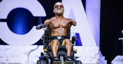 Brave bodybuilder electrocuted with 27,000V as a child says it ‘made him more than a man’