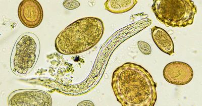 Should you love a parasite?