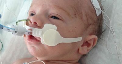 Apology after hospital mistakes saw Lucas starved of oxygen for nine minutes