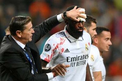 Champions League: Bloodied Antonio Rudiger grabs late Real Madrid point as Kylian Mbappe nets amid fresh row