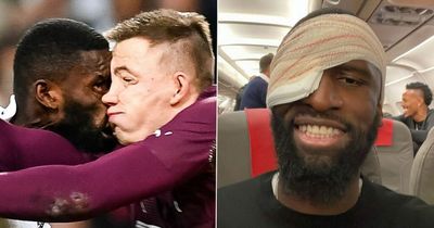 Antonio Rudiger issues update after suffering brutal head injury in sickening clash