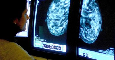 'Sneaky' form of aggressive breast cancer has unusual symptoms