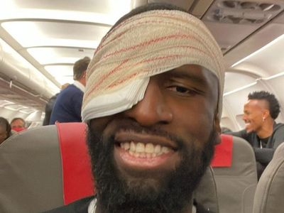 Real Madrid’s Antonio Rudiger issues update after horror injury against Shakhtar