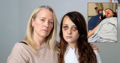 Calling out bullies is vital first step after schoolgirl 'lured to park and attacked'