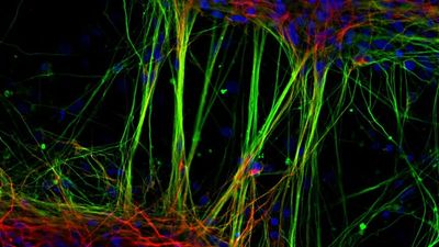 These are the top 20 photos from the 2022 Nikon Small World Photo Microscopy Competition as chosen by expert judges