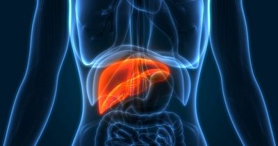One in five adults in Bristol may be unaware they have liver damage