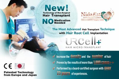 The Latest Non-surgical Hair Transplant Technique with No Medication Needed!