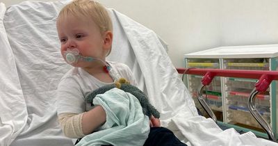 Tot's skin 'peeled off' after pouring mug of scalding tea on himself in horrific accident