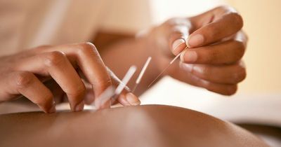 What is acupuncture and can it help with arthritis or sciatica pain?