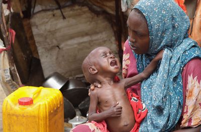One child a minute being admitted for malnutrition treatment in Somalia: UNICEF
