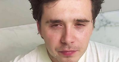 Brooklyn Beckham in tears as he attempts controversial One Chip challenge