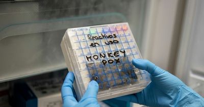 New UK monkeypox research consortium given £2m to tackle disease