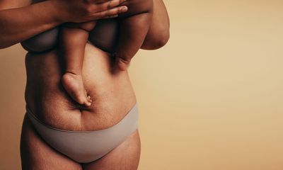 Post-pregnancy body positivity? On Instagram, it’s hard to find
