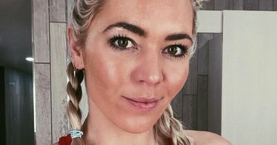 A Place in the Sun star shows facial scar for first time after being hit by a moped