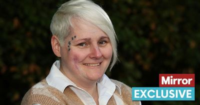 Mum scarred for life after splash of oven cleaner burns huge black hole in face