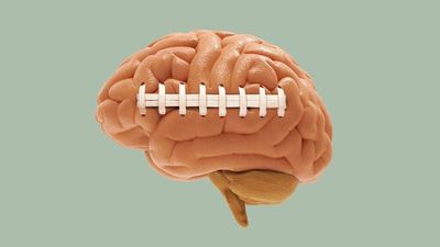 NCAA braces for landmark CTE trial