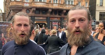 Hunky House of the Dragon twins looks unrecognisable from Shameless and Emmerdale roles