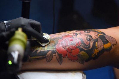 ‘Like being burned with cooking oil’: how tattoo removal became a booming business