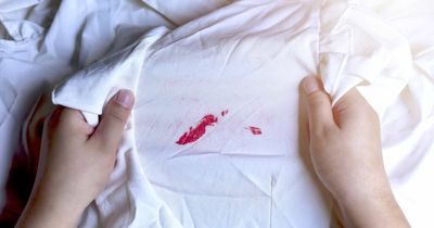 Cleaning whizz shares 80p trick to get stains out of white shirts - including make-up