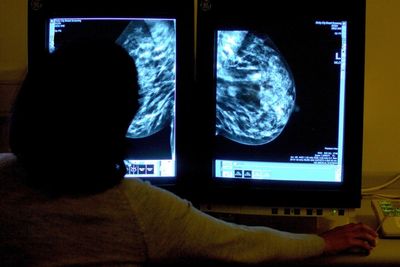 NHS trusts routinely fail to hit urgent cancer target – data