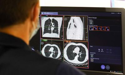 Seven in 10 NHS trusts in England failing to hit cancer referrals target