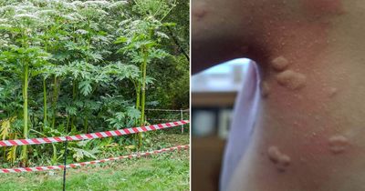 Boy, 8, rushed to hospital after brush with 'UK's most dangerous plant' amid warning