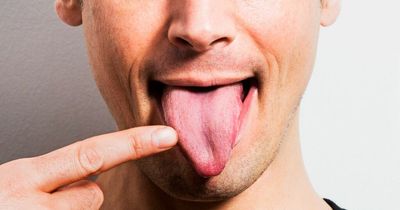 What your tongue say about your health - including hair and spots