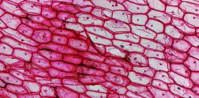 The unusual ways viruses and parasites use their cell membranes to spread – and how scientists are fighting back