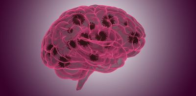 Long COVID: how lost connections between nerve cells in the brain may explain cognitive symptoms