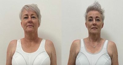 Biscuit-loving mum sheds two stone after life-threatening health scare