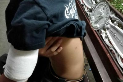 Marauding teens, dangly-bits thief, cheeky druggie