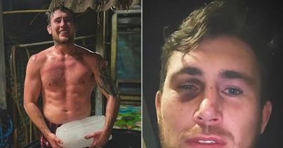 Darren Till shows off worrying eye injury ahead of Brit's belated UFC return