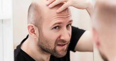 3 early signs of Type 2 diabetes found in your hair you should never ignore