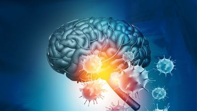 COVID-19 activates similar response to Parkinson's disease, study suggests