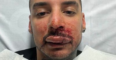Glasgow man's lip ripped off by 'anxious' dog in horrific house party attack