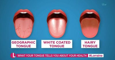 What your tongue can tell you about your health