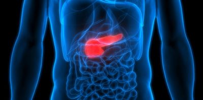 Pancreatic cancer could be diagnosed up to three years earlier – new study