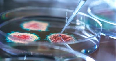 Previous Covid infection could increase your risk of catching other serious illnesses