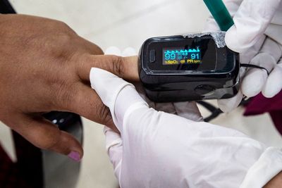 FDA advisers meet on racial disparities in pulse oximeters