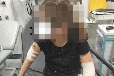 Girl, 9, ‘lucky to be alive’ after being mauled by pitbull in Golders Green