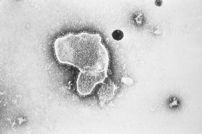 LOCALIZE IT: Surge in childhood virus strains hospitals