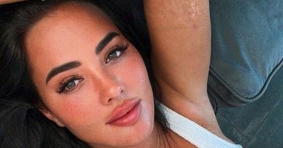 Yazmin Oukhellou shares photos of her scars that remind her she 'survived' horror crash